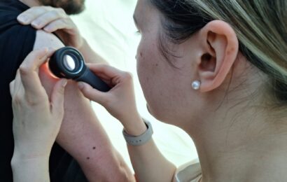 O dnech melanomu si nechalo v Pardubicích a Litomyšli zkontrolovat svá znaménka rekordně  téměř 1100 lidí